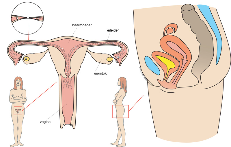 Sterilisatie van de vrouw: zo werkt het